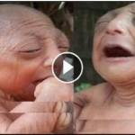 Mother Gives Birth to Miracle baby